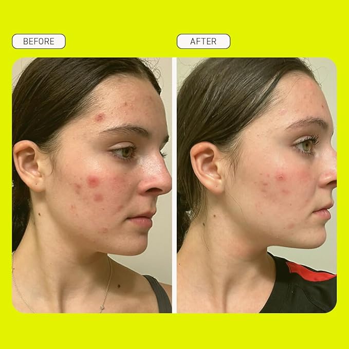 Evereden Preppy Skincare Collection with Triple Green Tea: Teen Skincare Steer Clear Balancing Jelly Cleanser Teen Face Wash, Let's Bounce Gel-Cream Moisturizer, & Balance Up Toner Pads for Face