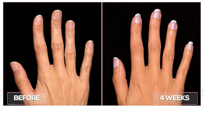 Perfect Formula Nail Collection - The Perfect Keratin Nail Treatment Manicure - A "Suit of Armor for Your Nails" - 4 pieces.