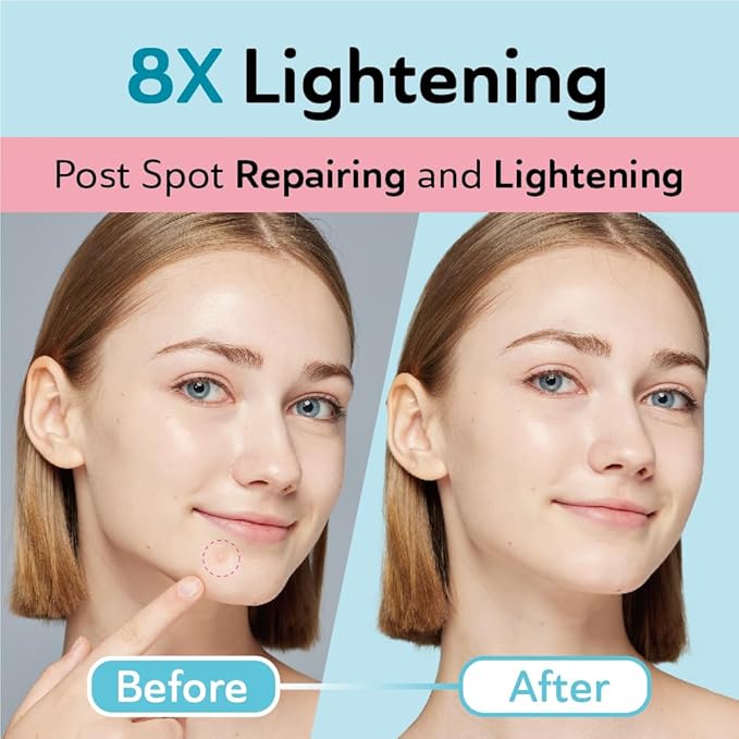 Acne & Post Acne Patches - Hydrocolloid Pimple Care with TXA & CICA for Active Acne & Post-Inflammatory Dark Spots - Day and Night Use - UPGRADED (Post Acne - 132 Count - 1 Size)