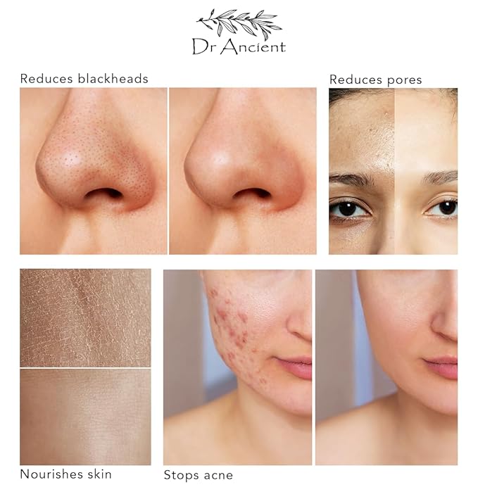 Tea Tree Soap Bar Organic Natural Vegan Traditional Handmade Antique - Antibacterial, Effective For Acne - Absolutely No Chemicals! Pure Natural Soap!