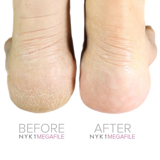 NYK1 Pink MEGAFILE Foot File Pedicure Rasp The Original with NYK1 Curved Smoothie Super Sharp Extra Large Micro Files MEGA File Skin Grater Remove Calloused Dry Rough Dead Skin in Seconds Add on Item