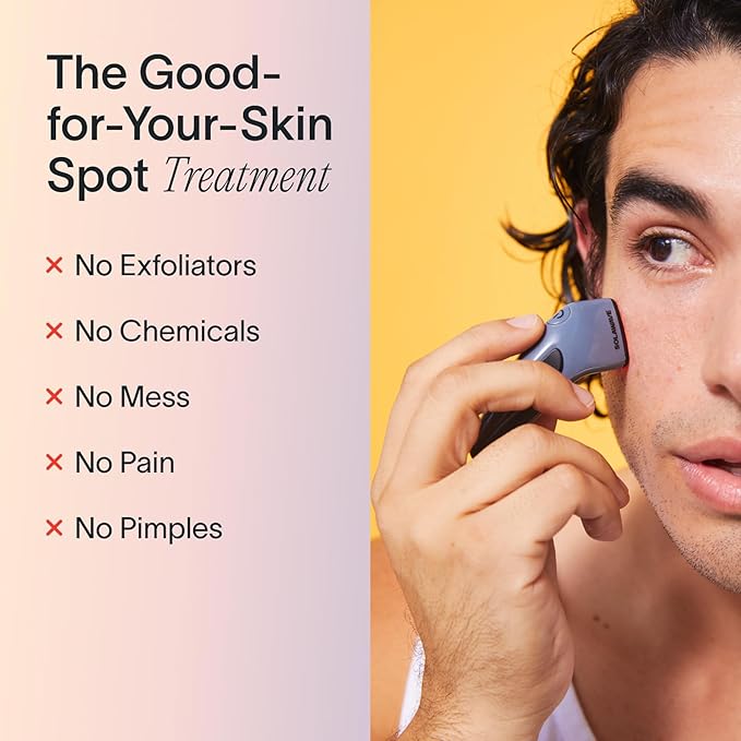 Solawave Bye Acne Spot Treatment | Premium Pimple Red Light Therapy & Blue Light Recovery | Use Before Pimple Patches | Acne Care Light Device | Face Care Must-Have | Solawave Original