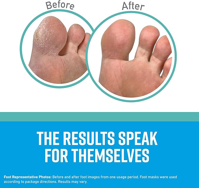 O'Keeffe's for Healthy Feet Intensive Moisturizing Foot Mask; Guaranteed Relief for Extremely Dry; Rough Feet; One Pair Single-Use Hydrating Foot Mask Socks; (Pack of 4)