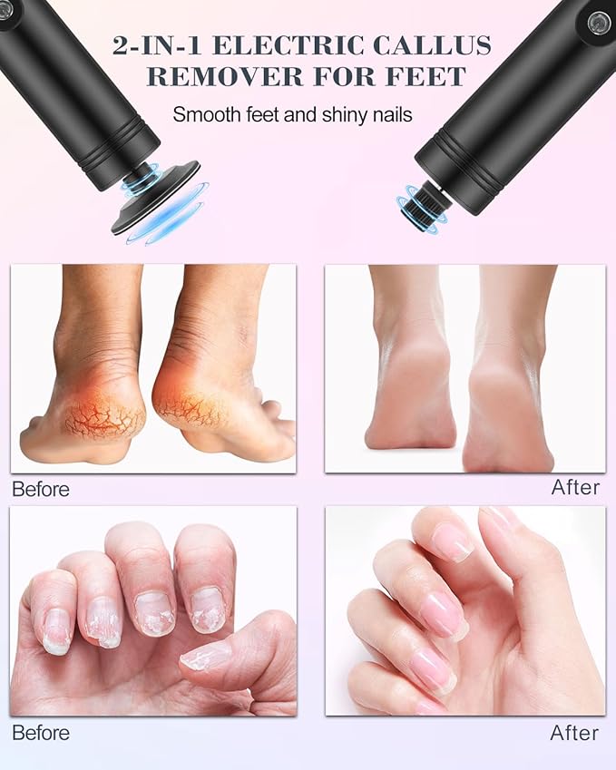 2 in 1 Electric Callus Remover & Foot Sander, 2000mAh Battery,9 Speed Adjustable Foot File Callus Remover with LED Display, Replaceable Sandpaper Discs, for Foot and Nail Care,Rose