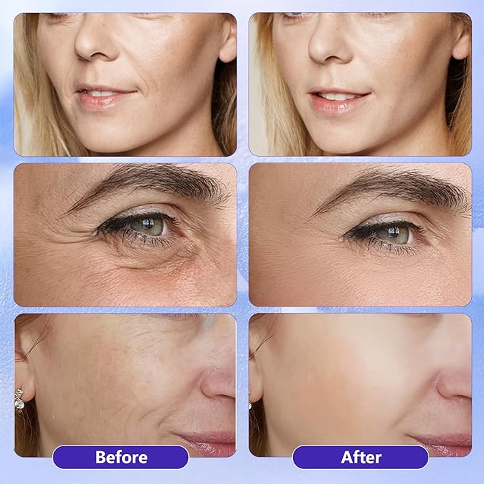 Hyaluronic Acid Face Serum,Vitamin C,Niacinamide Facial Serum,Facial Skin Care Set for Plumping,Anti-Aging/Wrinkle,Brightening,Ultra-Hydrating Hyluronic Acid Serum- Pack of 3,All Skin Type