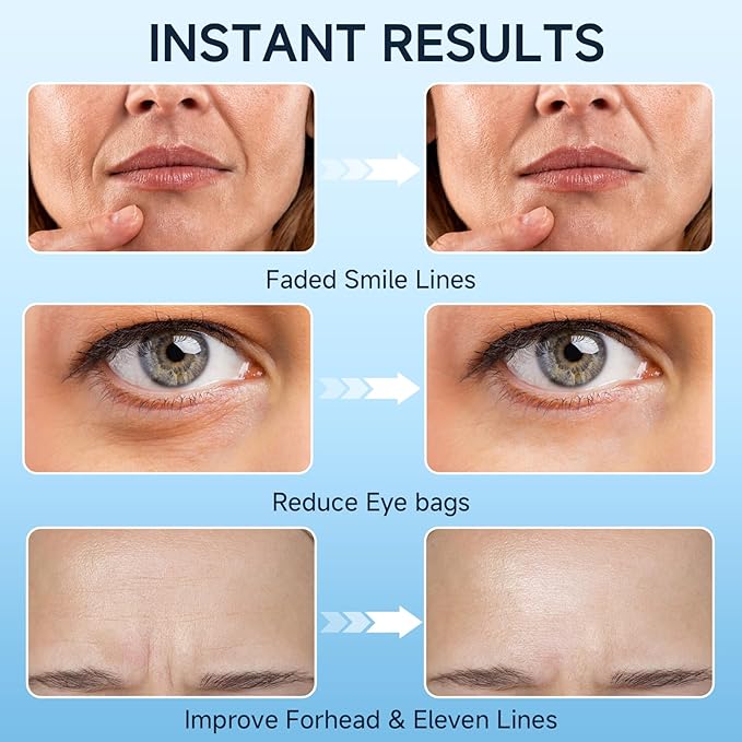 Under Eye Bags and Wrinkles, Under Eye Cream, Wrinkle Filler, Visibly Improves for Bags Dark Circles Treatment for Puffines, 15ml/0.5 fl.oz