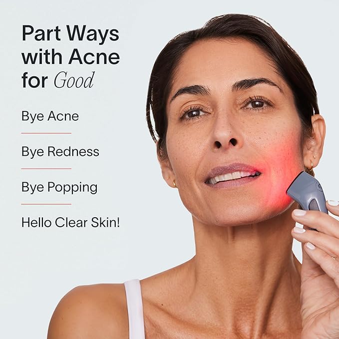 Solawave Bye Acne Spot Treatment | Premium Pimple Red Light Therapy & Blue Light Recovery | Use Before Pimple Patches | Acne Care Light Device | Face Care Must-Have | Solawave Original