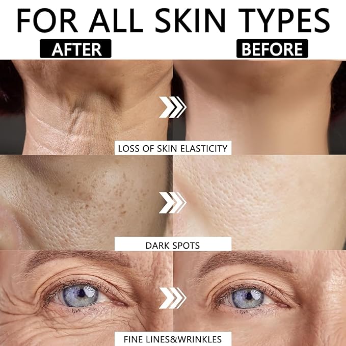 Elegacell Face Tightener Instant Face Lift Cream Temporary Frim Skin Tightening and Lifting Cream-Smooth the Look of Fine Lines - Daily Moisturizer for Women and Men - 100ml, 3.4 fl.oz