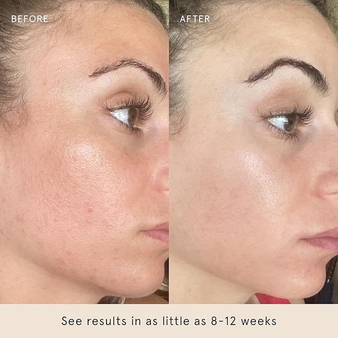 Barefaced Toning Pads (60 count) - Exfoliating Face Pads with 2% Glycolic Acid & Salicylic Acid - Brightens & Cleanses Skin, Clears Pores, Reduces Fine Lines & Wrinkles