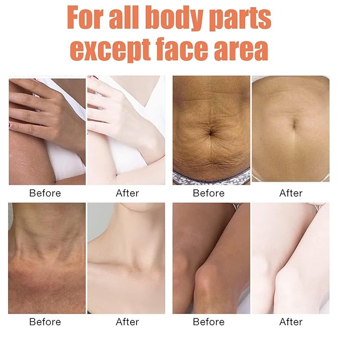 Be Glossy Smoothing Body Serum for Wrinkles - Infused with Hyaluronic Acid, Vitamin E, Glycerin and Shea Butter - Hydrating Nourishing Repairing for Silky Smooth Skin 60ML/2 Fl Oz