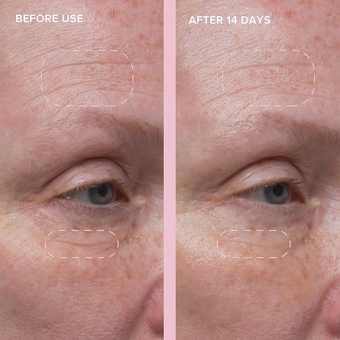 Alpyn Wild Nettle & Niacinamide Firming Serum | Visibly Smooth, Plump, & Moisturize | Reduce the Look of Fine Lines & Pores - For All Skin Types | 1 oz / 30 ml