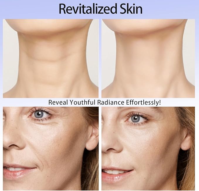 4 in 1 Facial-Device,Facial Wand,Red-Light-Therapy for Face and Neck