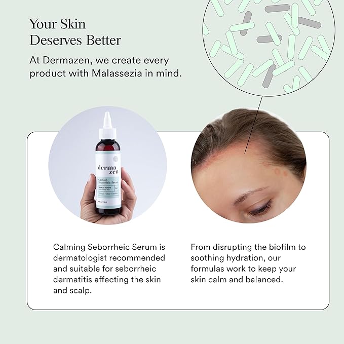 Calming Seborrheic Serum, Dermatologist Recommended, Topical Seborrheic Dermatitis Serum For Scalp, Face, and Body (8oz)