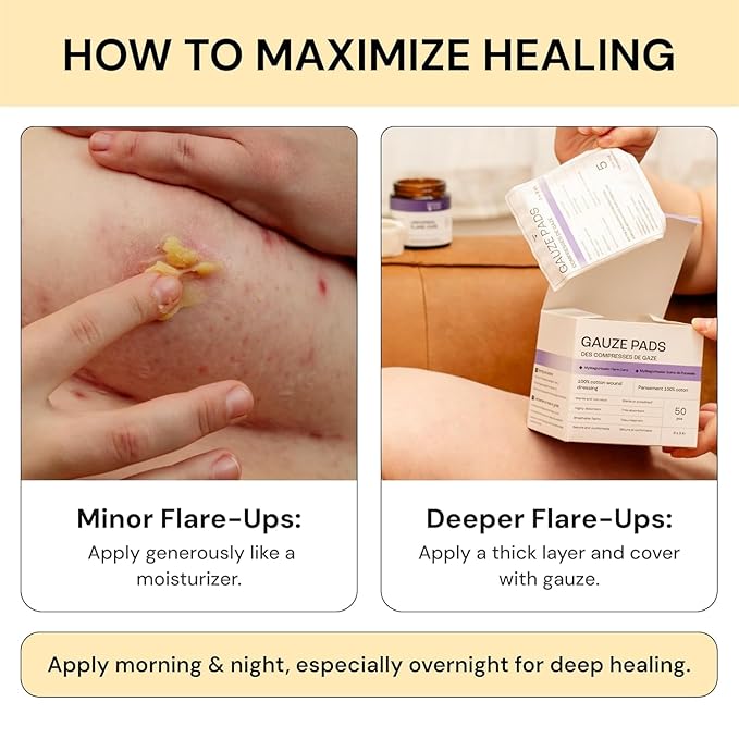 Thyme & Tea Tree Flare Care | Solution for Painful Pimples, Cystic Acne, Ingrowns, Folliculitis, Groin Flare Ups, Razor Bumps | Bartholin | Safe Flare-Up Solution with Egg Yolk Extract & Tea Tree 1 oz