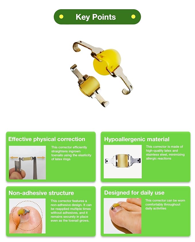 [XS/0.63inches/15-17mm] Ingrown toenail treatment by latex ring elasticity, usable in everyday life, Ingrown toenail corrector, Yellow/Silver