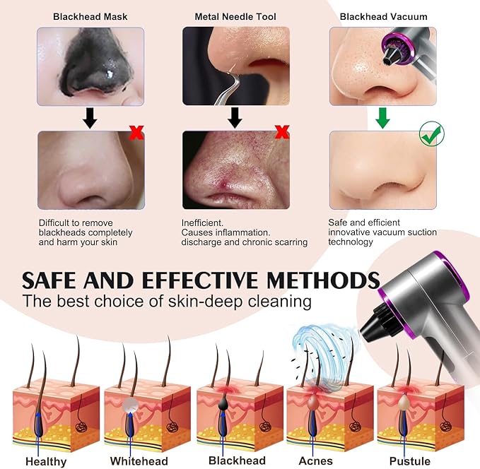 Blackhead Remover Vacuum with Heating, Blackhead Extractor 3 Adjustable Suction Levels 9 Modes, Pore Vacuum Blackhead Suction Remover, Comedone Extractor Kit for Deep Pore Cleaning (Purple)