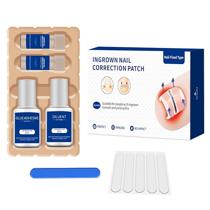 Ingrown Toenail Treatment, 10 packs Titanium Alloy Ingrown Toenail Corrector for all size foot, Ingrown Toenail Removal Kit for Curved Nail Repair, at Home Nail Kit Tools-Blue3