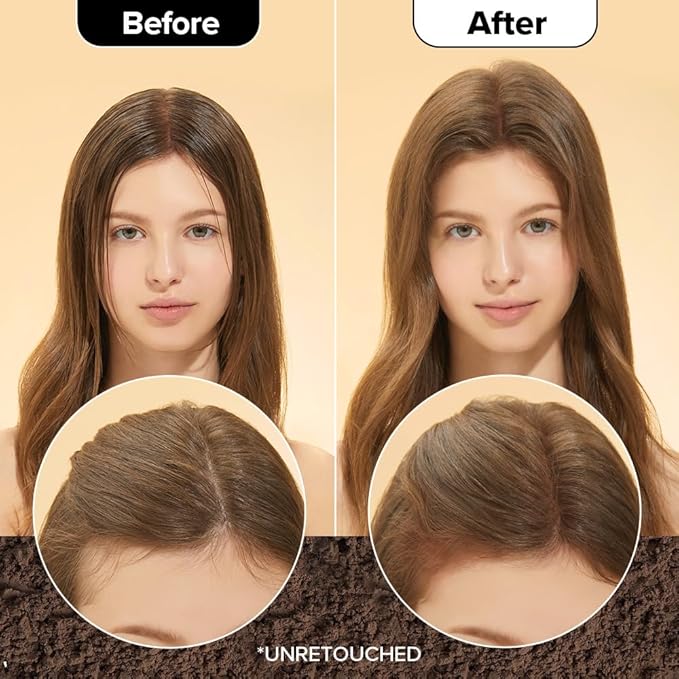 I DEW CARE Biotin Clarifying Dry Shampoo - Tap Secret Medium Brown | Strengthening & Volumizing, Powder Type, Refillable, Travel size, Non-aerosol, Brunette, Mother's Day, 0.24 Oz