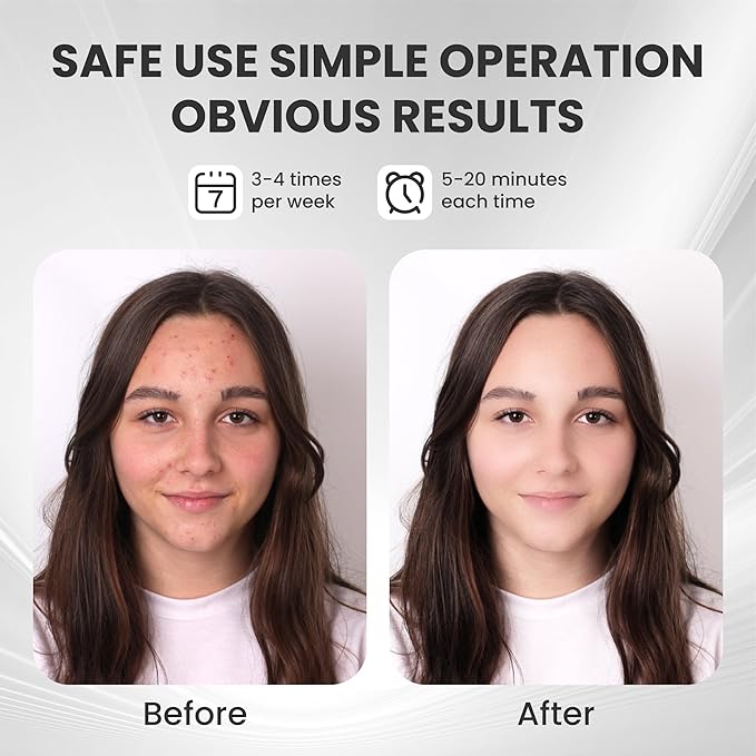 7-1 Colors LED Facial Skin Care Mask,Red Light Therapy Mask for Face, Cordless Led Face Mask Light Therapy,Salon or Home,White.