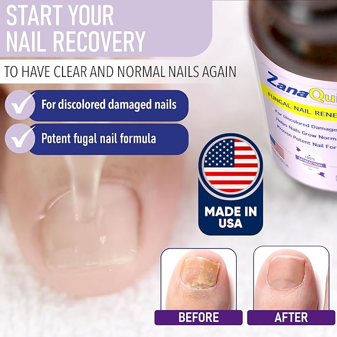 2 Step Toenail Fungus Treatment - Extra Strength Damaged Nail Solution With Renewal Drops and Disruptor - Repair Strategy Kit for Discolored Brittle Nails