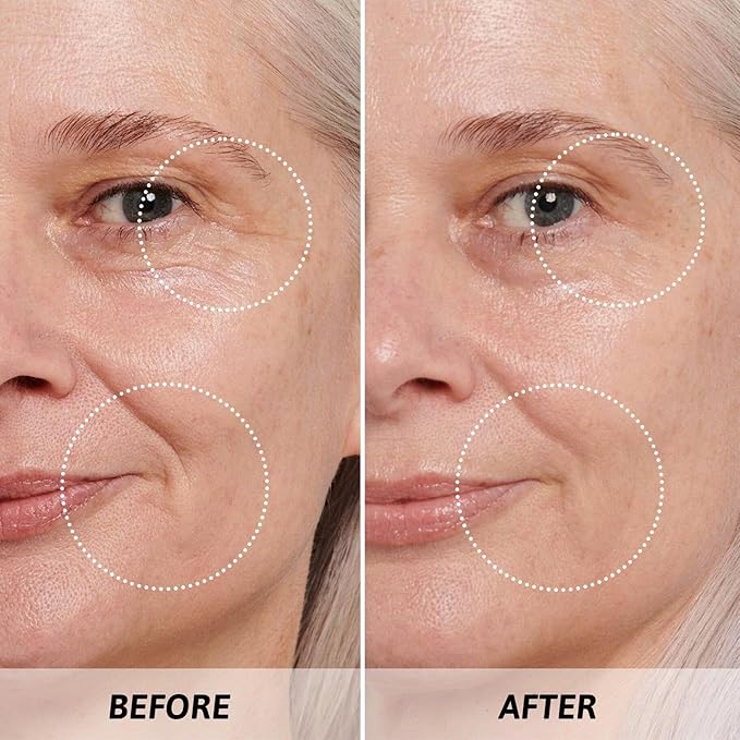 Mother's Day Gifts for Mom Skin Care Routine Kit for Women, Rose Essential Oil+Retinol+ Vitamin E, 10-Piece Complete Skin Care Set, Korean Skin Care Set, Birthday Gifts for Women