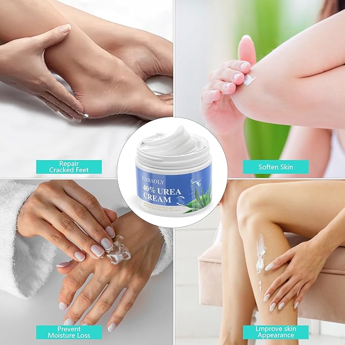 Urea Cream 40 Percent for Feet Maximum Strength, Urea Foot and Hand Cream with Powerful Hydration for Dry Skin, Cracked Heels, Deeply Moisturizing for All Skin Types 7.05oz