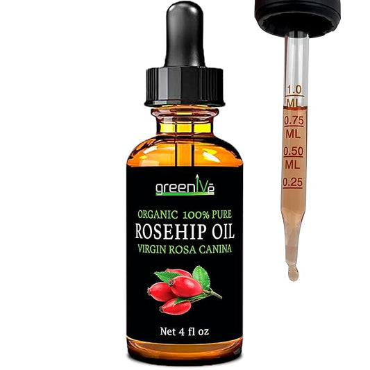 GreenIVe Rosehip Oil Rosa Canina 100% Pure Cold Pressed Virgin Oil Hair and Skin and DIY products (4oz dropper)