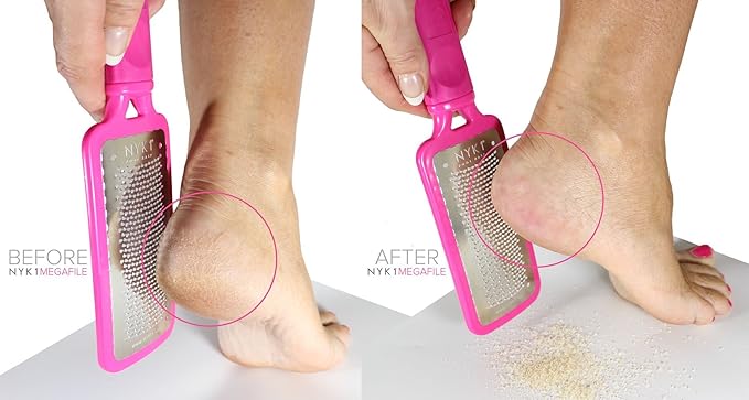 NYK1 Pink MEGAFILE Foot File Pedicure Rasp The Original with NYK1 Curved Smoothie Super Sharp Extra Large Micro Files MEGA File Skin Grater Remove Calloused Dry Rough Dead Skin in Seconds Add on Item