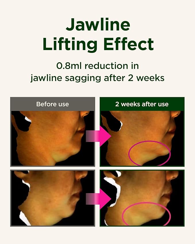 CKD Retinol Collagen Neck Cream with Gua Sha Massage Roller - Anti Aging Firming Cream for Neck & Jawline Lifting, Double Chin, and Décolleté Wrinkle Care. Korean Skincare. 1.69 fl oz