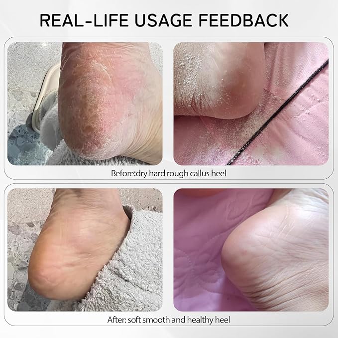 Rechargeable Metal Electric Foot File Callus Remover, Grinder Tool for Feet Dead Skin Professional Pedicure Wand Heel Scraper with 60pcs Replacement Sandpaper Discs (Black)