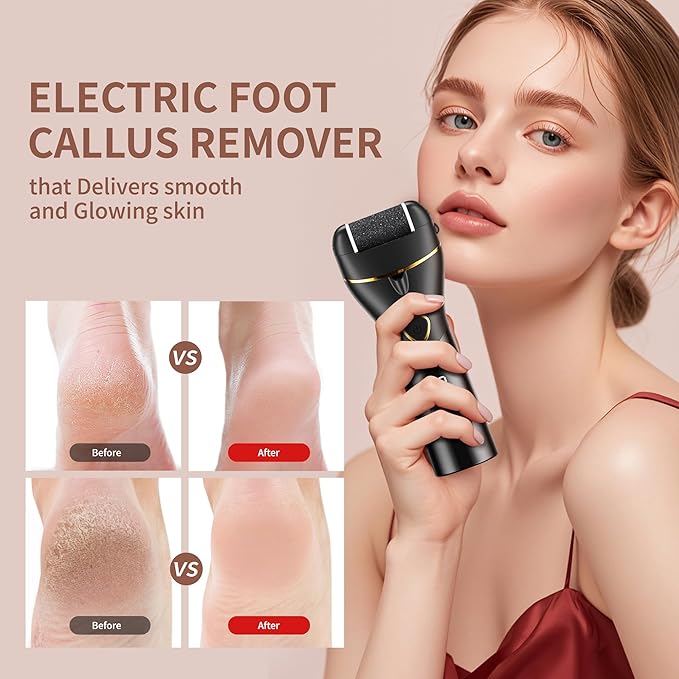 Foot Scrubber Rechargeable,callus Remover For Feet, Electric Foot Callus Remover Kit, Ipx6 Washable Cleaning, 4H Long Battery Life,Professional Pedicure Tools For Dead,hard Cracked Dry Skin Ideal Gift
