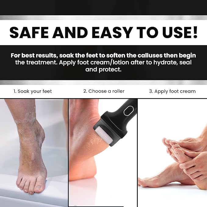 Electric Foot Callus Remover - Rechargeable/Portable Pedicure Tool - Water Resistant - Pedicure Tool Kit for Men - Three Large Wide Roller Heads - for Cracked, Dried, Rough Calluses
