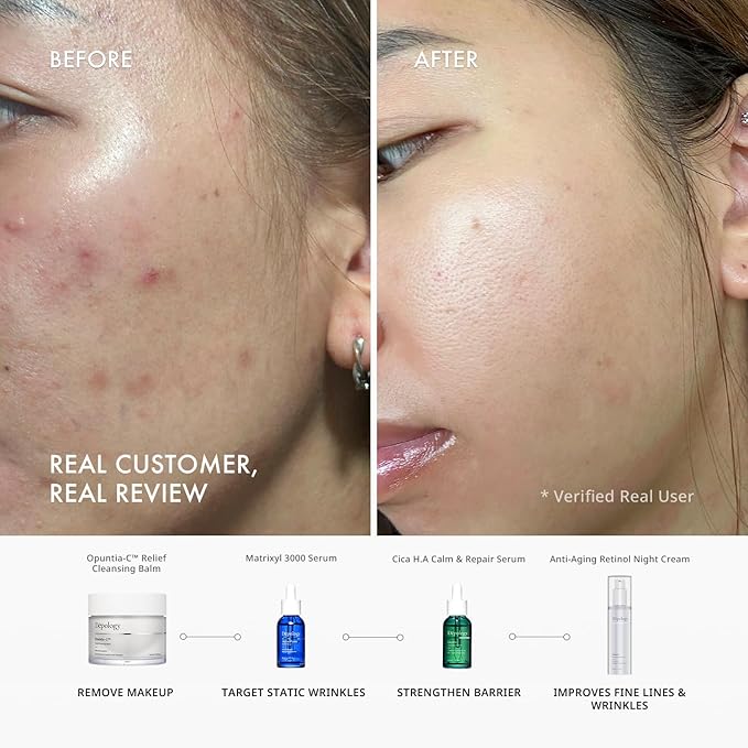 depology Opuntia-c™ Relief Cleansing Balm (3.4 fl Oz) | Moisturizing Makeup Remover | Gently Makeup Remove Blam | Korean Skin Care