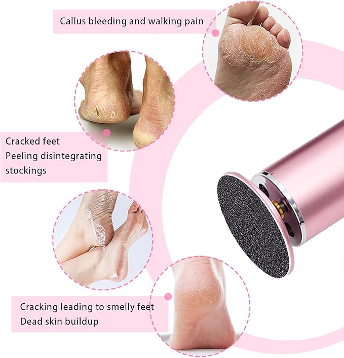 60 Pcs Sandpaper Set 1.7'' x 1.7'' for Electric Foot Callus Remover,Pedicure Disc,Sander Discs Replace Set - 1 Box (30 Fine Grit and 30 Coarse Grit)