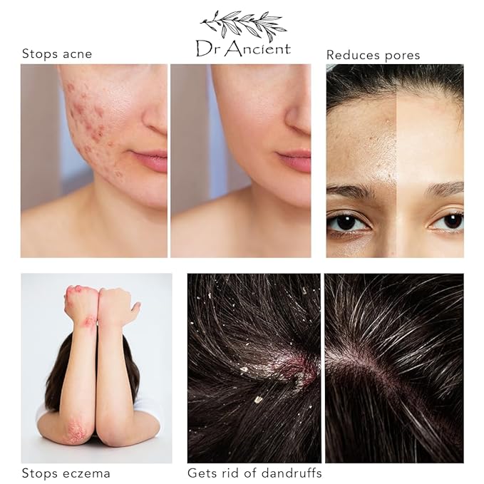 Stinging Nettle Soap + Pine Tar Soap Organic Natural Vegan Traditional Handmade Antique - Absolutely No Chemicals!