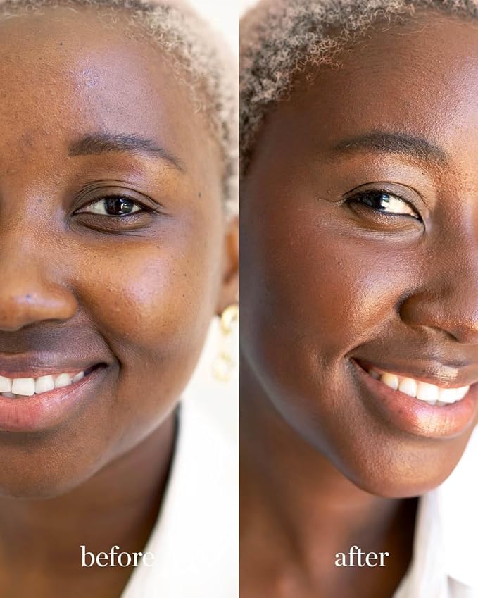 Ere Perez - Natural Arnica All-Cover Pot Concealer | Med-Full Coverage, Satin Finish, Calming, Nourishing | Vegan, Cruelty-Free, Clean Beauty (Dolce, 0.18 oz | 5 g)