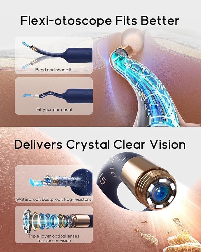 Bebird Earsight Plus D39R Ear Wax Removal Tool Camera, FSA HSA Eligible Items, Ear Cleaner with Flexible Ear Camera Otoscope, Visual Ear Pick Tweezers Wax Remover, Ear Cleaning Kit for Family