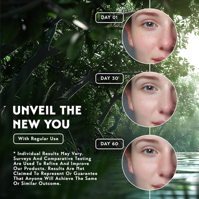 O NATURALS 100% Natural Bar Soap - Gift Set - Organic Ingredients & Essential Oils - Spa Gifts for Women & Men, Body Wash & Face Soap - 4PC Kojic Acid Turmeric Soap