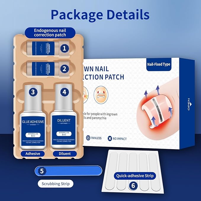 Ingrown Toenail Treatment, 10 packs Titanium Alloy Ingrown Toenail Corrector for all size foot, Ingrown Toenail Removal Kit for Curved Nail Repair, at Home Nail Kit Tools-S01