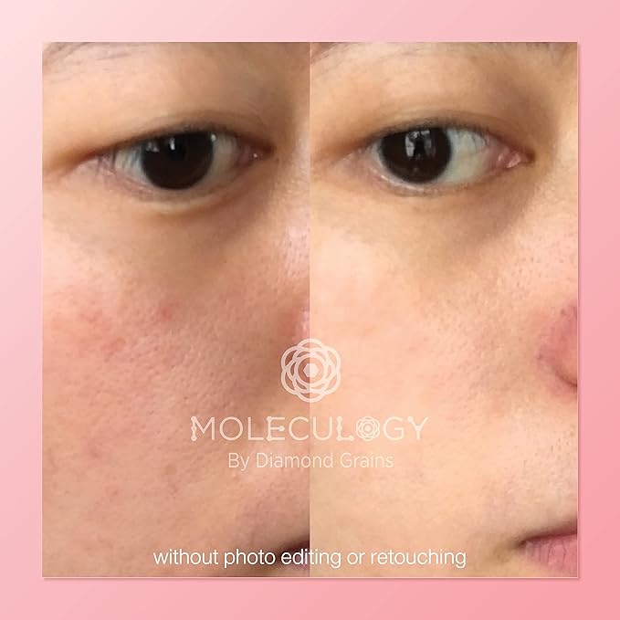Diamond Grains GlassyX Korean Skin Care for K-Pop Porcelain Skin Glow Effect by MOLECULOGY - The Perfect Brightening & Glassy Skin Effect that Most Korean Uses for both Women & Men