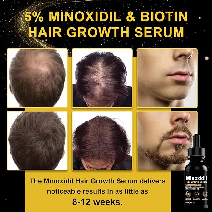 5% Minoxidil Hair Growth Serum, Topical Minoxidil for Men and Women, Hair Regrowth Treatment for Scalp Hair Loss and Thinning, With Biotin