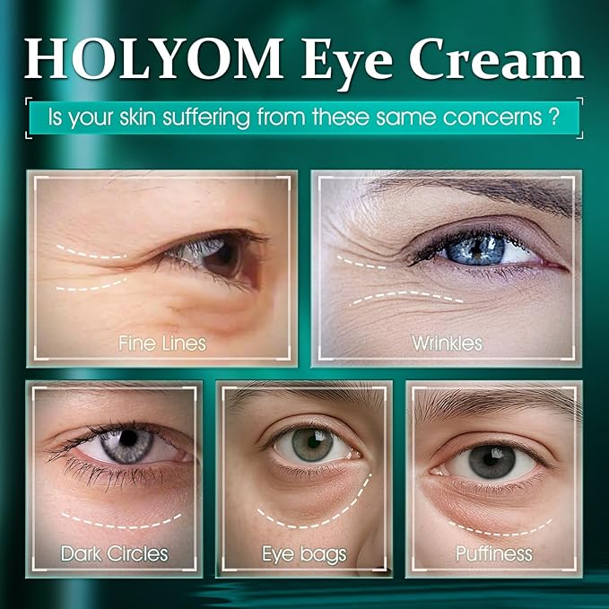 Retinol Under Eye Cream - Anti Aging Eye Cream for Eye Bags, Dark Circles, and Fade Wrinkles, Fine Lines Skin Care Treatment for Women and Men, (1 Fl Oz)