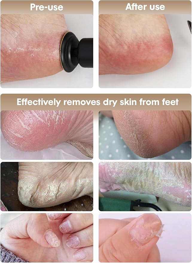 Electric Foot Callus Remover - 2 in 1 Cordless Electric Foot File Nail Grinder,Electric Callus Remover for Feet with 3 Modes,Dry Skin Remover for Feet (Black)