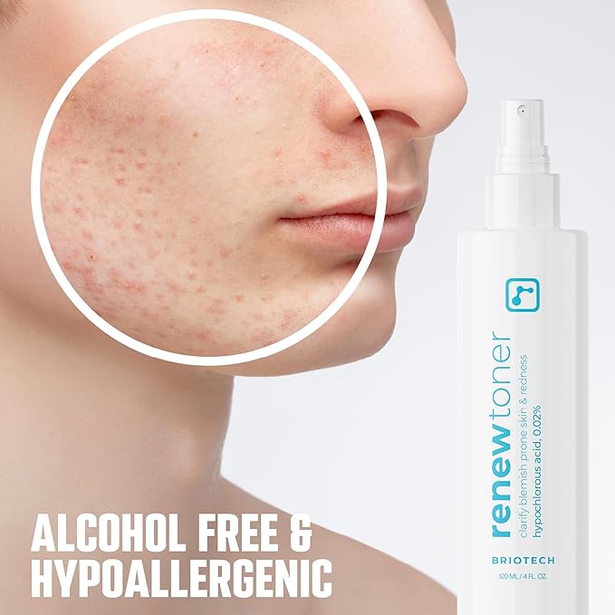 BRIOTECH Skin Renew Toner, Hypochlorous Acid Spray Topical Skin Spray for Face and Skin, Minimize Appearance of Blemishes, Soothing Mist for Redness & Bumps, Stocking Stuffer, 4 fl oz ea, 2 ct