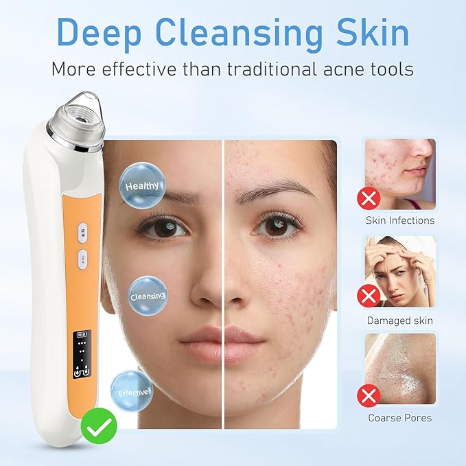 Blackhead Remover Vacuum with HD Camera, USB Rechargeable Pore Cleaner for Men and Women, 6 Suction Heads & 3 Adjustable Power Levels(Orange)