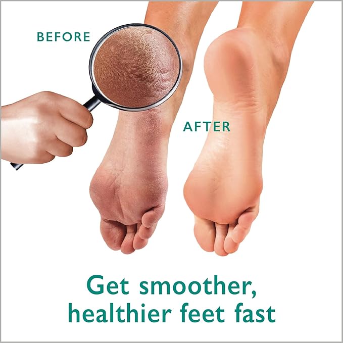 Max Strength 42% Urea Gel + Foot Scrubber + Shea Butter Cream Bundle