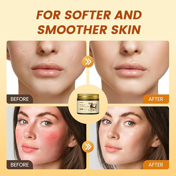 Beef Tallow for Skin 2oz, Whipped Beef Tallow and Manuka Honey Balm, Beef Tallow for Face and Body, Unscented Skin Care for Dry and Sensitive Skin, Natural Tallow Balm for Hydration and Nourishment