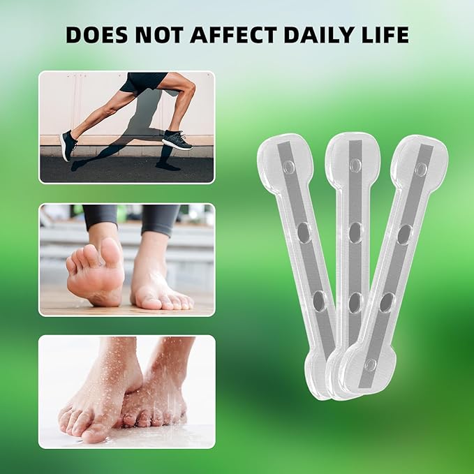 Ingrown Toenail Treatment, Nails Corrector Tool, Professional Toenail Correction Remover Repair Removal Kit for Rapid Relief