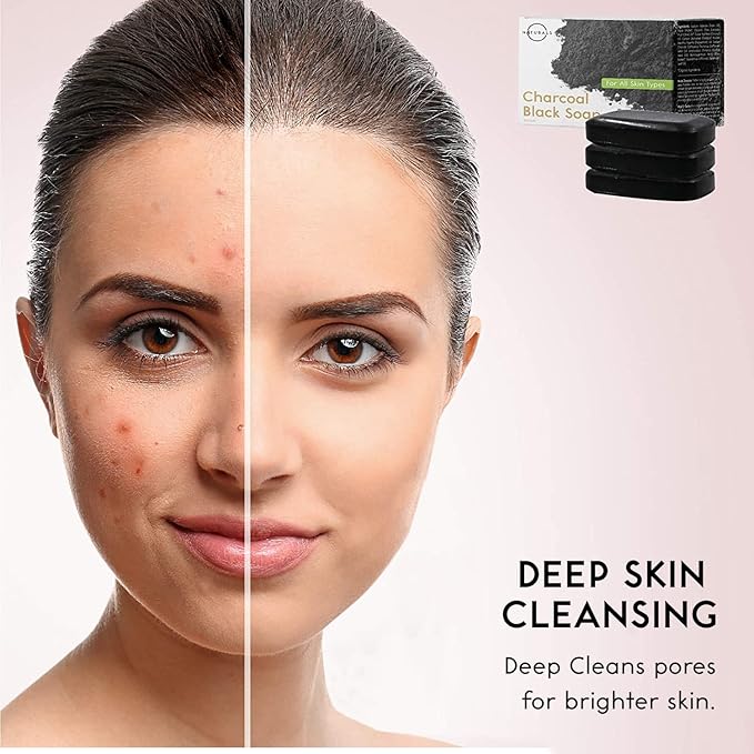 O NATURALS 100% Natural Bar Soap - Gift Set - Organic Ingredients & Essential Oils - Spa Gifts for Women & Men, Body Wash & Face Soap - 3PC Charcoal Soap