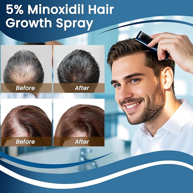 5% Minoxidil for Men and Woman, Minoxidil for Beard Growth, Hair Regrowth for Men and Woman, Treatment for Scalp Hair Loss Hair Thinning - Increase Thickness and Volume Faster